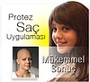 Www.demohair.com ile saç protez saç ekım tum saç sorunlarında çözüm üretıyoruz.