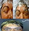 Kalıcı Makyaj Permanent Makeup Yapanlar İstanbul Dövme Salonu
